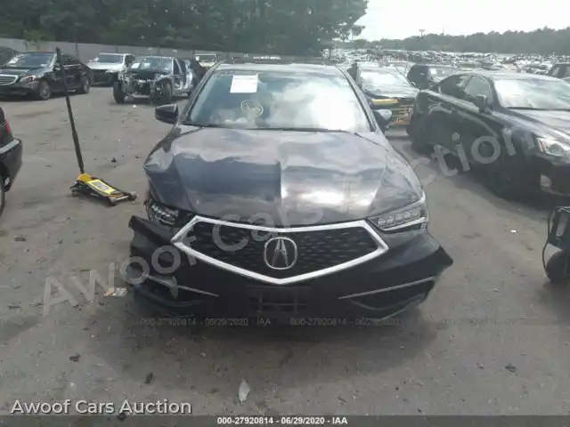2018 Acura TLX 19UUB1F36JA000021 — Iaai auction photo 6
