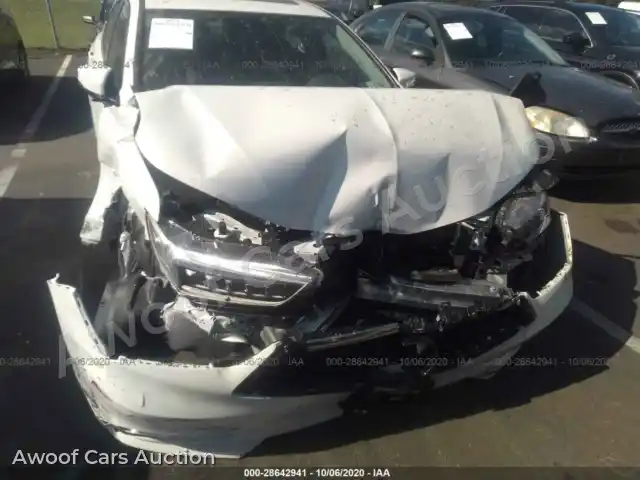 2020 Acura TLX 19UUB1F37LA016859 — Iaai auction photo 6